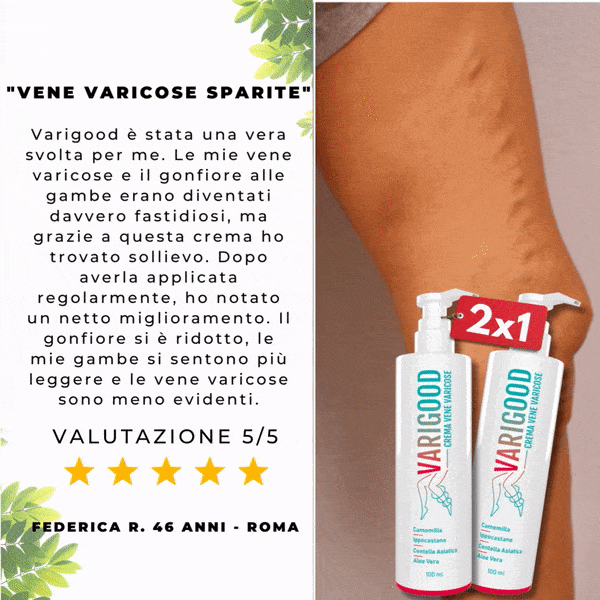vene varicose crema